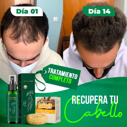 OUHOE - SPRAY PARA CRECIMIENTO DE CABELLO