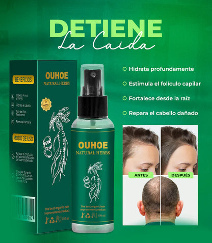 OUHOE - SPRAY PARA CRECIMIENTO DE CABELLO