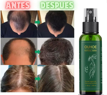 OUHOE - SPRAY PARA CRECIMIENTO DE CABELLO